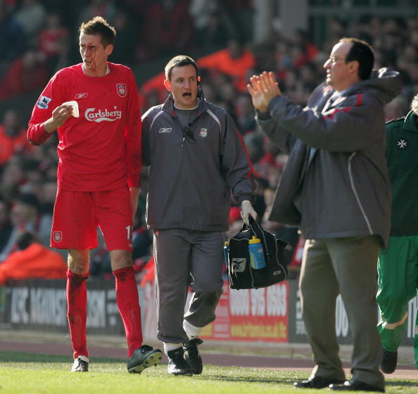 手套开合点 手套开合点